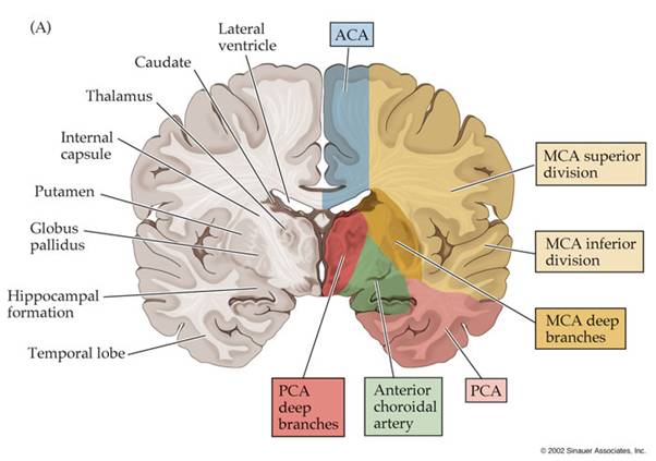http://missinglink.ucsf.edu/lm/ids_104_cns_injury/response%20_to_injury/Injury_Images/CerArtDistBlum1.jpg