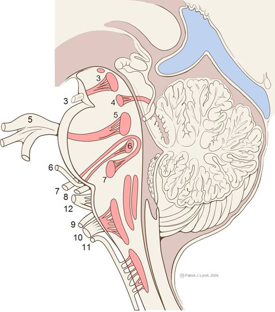 http://images.radiopaedia.org/images/943/c908d8ec29646fdfcd1ad378c00d60.jpg