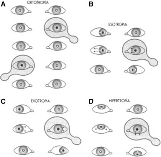 http://www.biomedcentral.com/content/figures/1471-2431-13-12-3.jpg