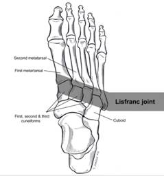 http://e-dok.rm.dk/e-dok/e_760102.nsf/$CXIV/ATTACH-RMAP-978SDP/$FILE/lisfranc.jpg