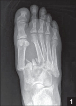 http://www.healio.com/orthopedics/journals/ortho/%7B30420b30-56c1-47fe-8c6b-0a352112fd78%7D/%7E/media/Journals/ORTHO/2011/11_November/10_3928_01477447_20110922_23/fig1.ashx