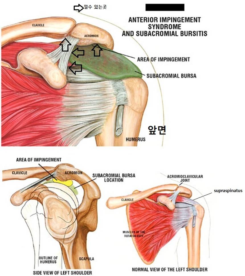 june4impingement.jpg