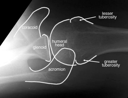 http://uwmsk.org/RadAnat/images/ShoulderAxLabelled.jpg