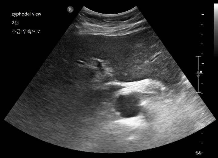 Liver2.jpg