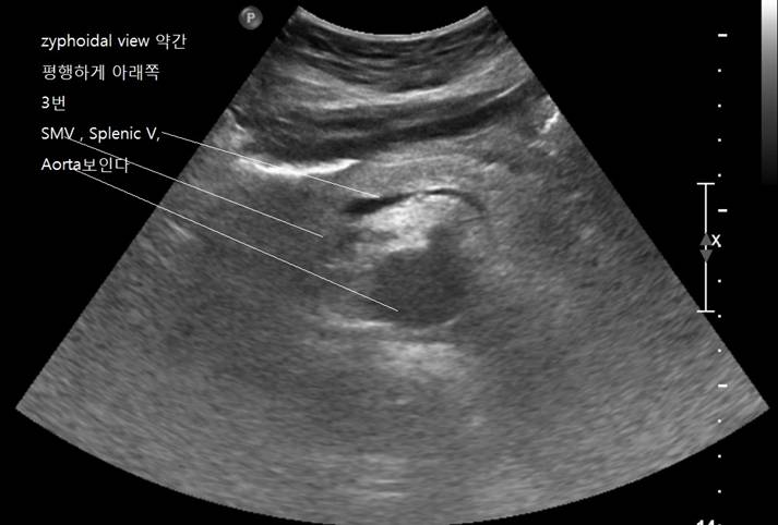 Liver3.jpg