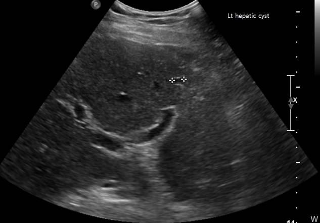 renal1.jpg