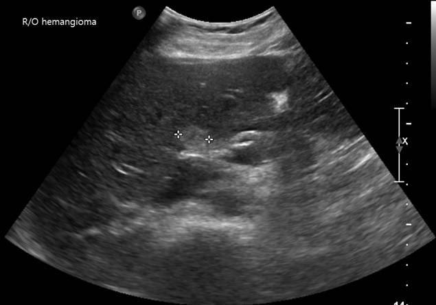 Liver345.jpg