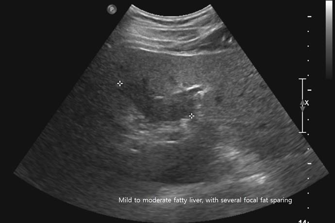fatsparingarea.jpg
