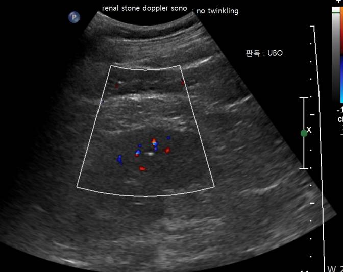 renal.jpg