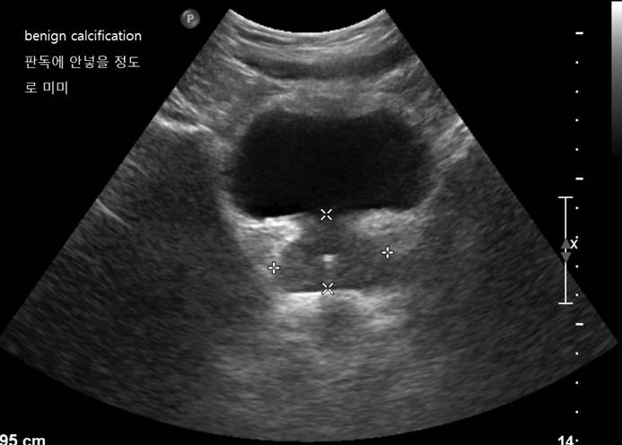 Liver34.jpg