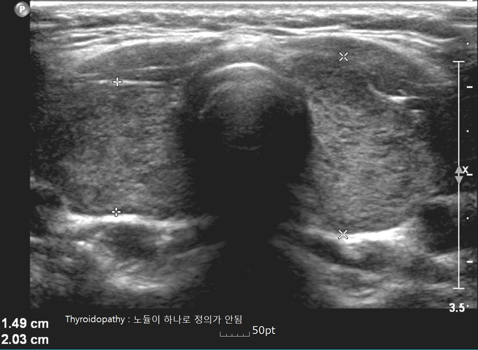 thyroidopathy.jpg
