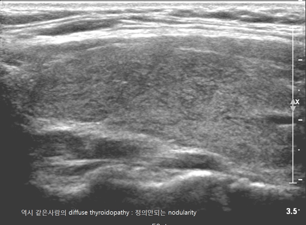 thyroidopathy1.jpg