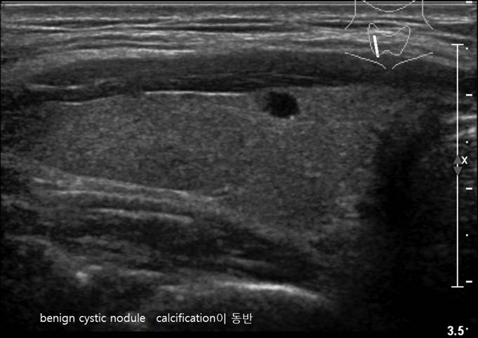 thyroid5.jpg