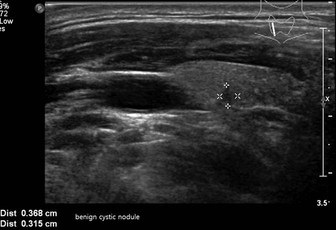 thyroid567.jpg