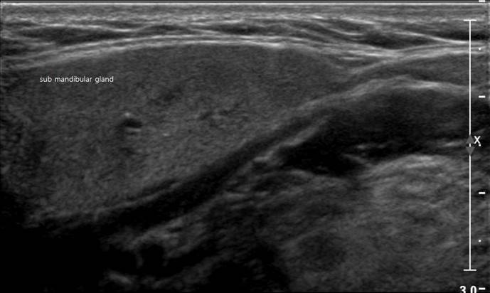 thyroid1.jpg