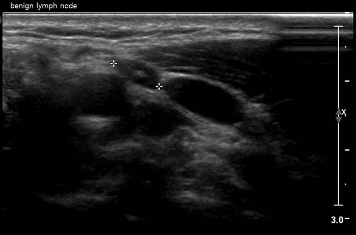 thyroid123.jpg