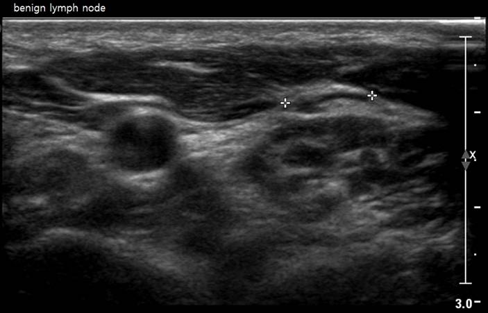 thyroid1234.jpg