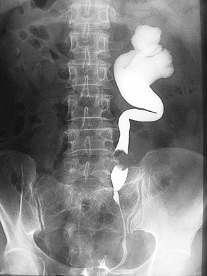 http://cme.medcomasia.com/cmequiz/src/radiology/quiz24-200409/radiology1.gif