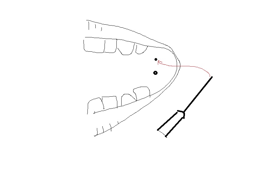 dimple2.jpg