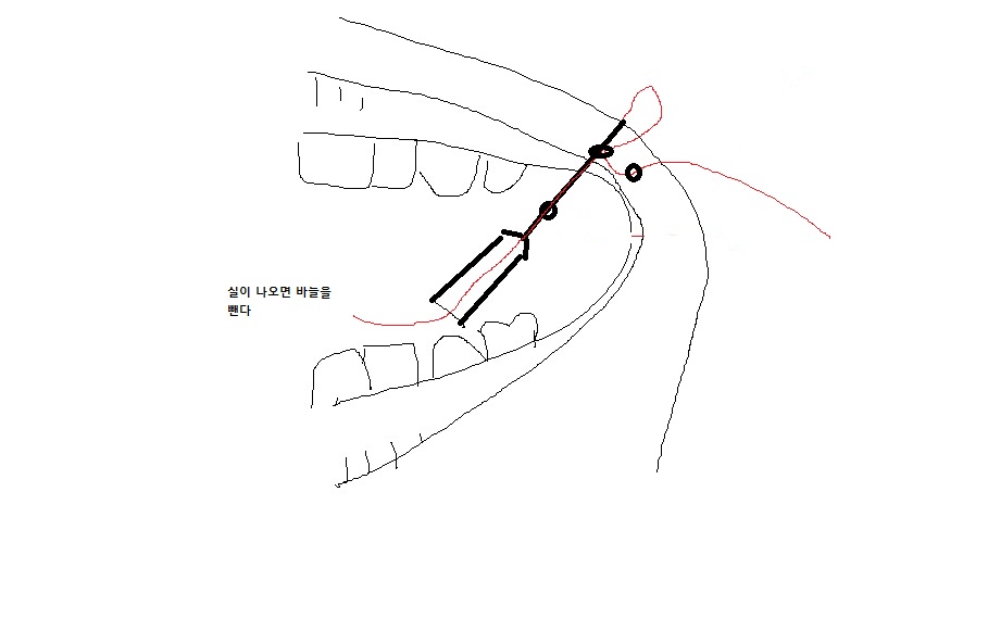 dimple4.jpg