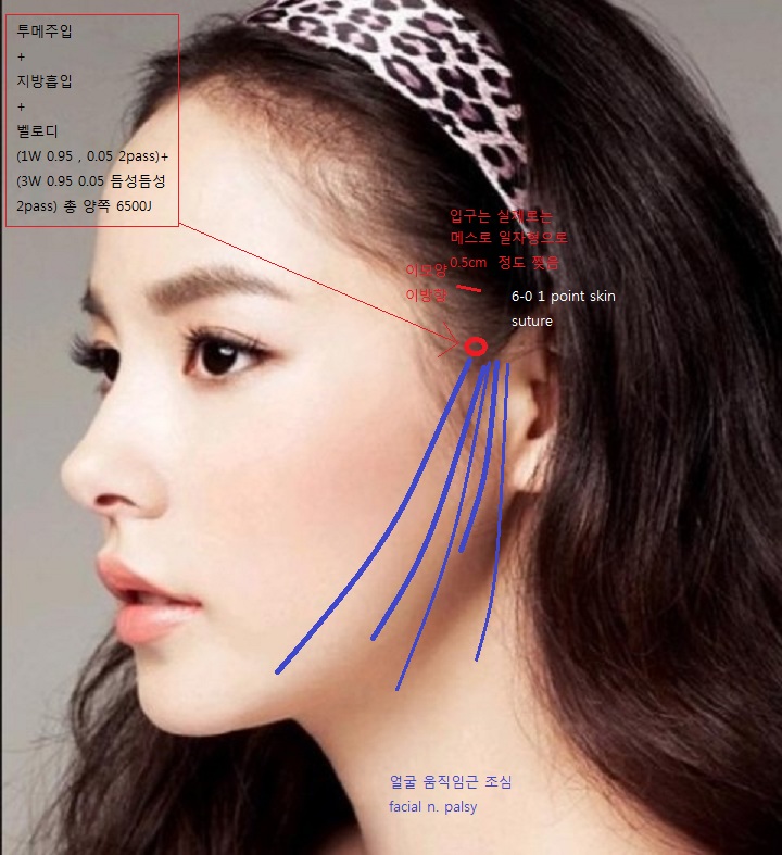 facialFG.jpg