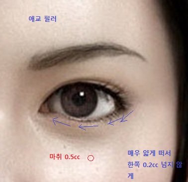 agyu filler.jpg
